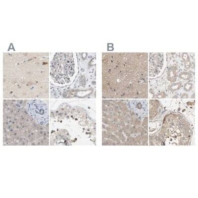 Immunohistochemistry-Paraffin: WDR68 Antibody [NBP1-92590]