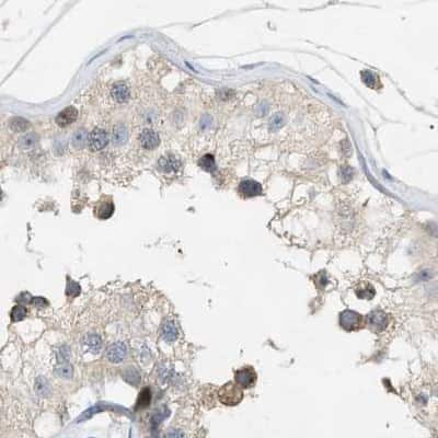 Immunohistochemistry-Paraffin: WDR68 Antibody [NBP1-92590]