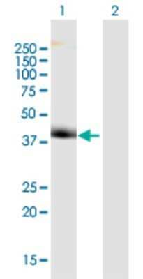 Western Blot: WDR68 Antibody [H00010238-B01P]