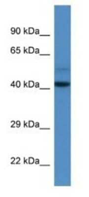 Western Blot: WDR68 Antibody [NBP1-74157]