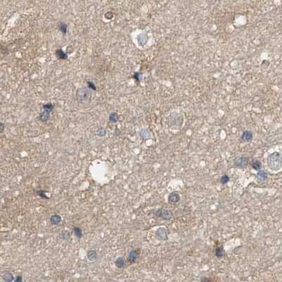 Immunohistochemistry-Paraffin: WDR68 Antibody [NBP1-92589]