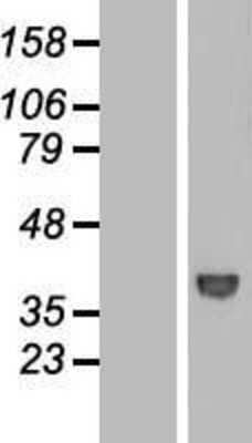 Western Blot: WDR68 Overexpression Lysate [NBL1-17825]