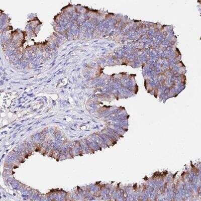 Immunohistochemistry-Paraffin: WDR69 Antibody [NBP1-92591]