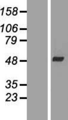 Western Blot: WDR69 Overexpression Lysate [NBL1-17826]