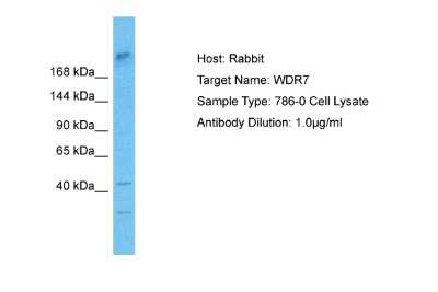 Western Blot: WDR7 Antibody [NBP2-86378]