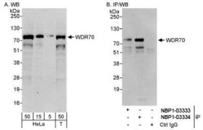 Western Blot: WDR70 Antibody [NBP1-03334]