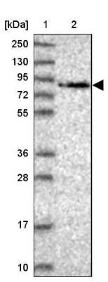 Western Blot: WDR70 Antibody [NBP2-48892]