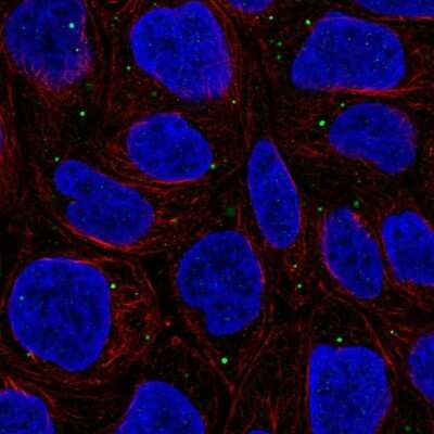 Immunocytochemistry/ Immunofluorescence: WDR72 Antibody [NBP2-57458]