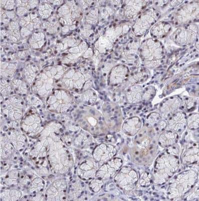 Immunohistochemistry-Paraffin: WDR72 Antibody [NBP2-31676]