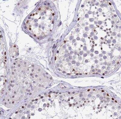 Immunohistochemistry-Paraffin: WDR72 Antibody [NBP2-31676]