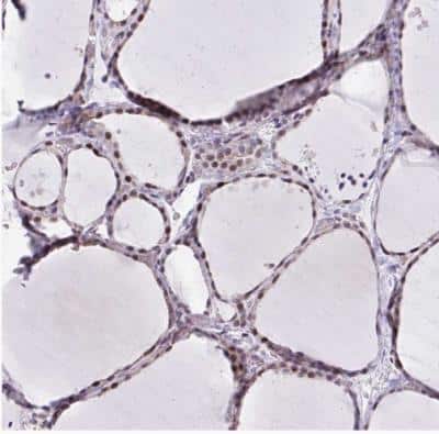 Immunohistochemistry-Paraffin: WDR72 Antibody [NBP2-31676]