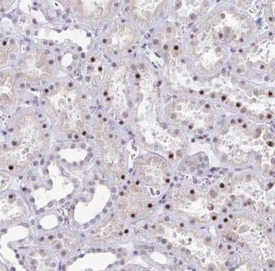 Immunohistochemistry-Paraffin: WDR72 Antibody [NBP2-31676]