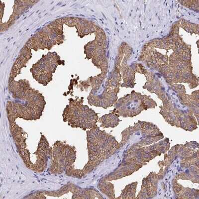 Immunohistochemistry-Paraffin: WDR72 Antibody [NBP2-31800]