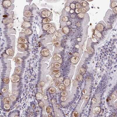 Immunohistochemistry-Paraffin: WDR72 Antibody [NBP2-31800]