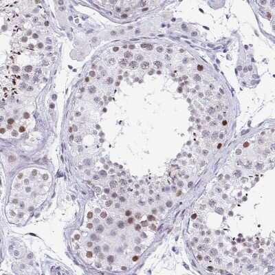 Immunohistochemistry-Paraffin: WDR72 Antibody [NBP2-31800]