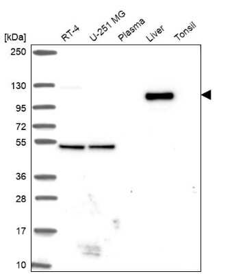 Western Blot: WDR72 Antibody [NBP2-31800]