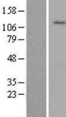 Western Blot: WDR72 Overexpression Lysate [NBL1-17827]