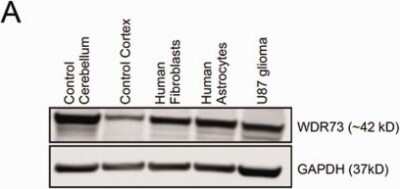 Western Blot: WDR73 Antibody [NBP1-82219]