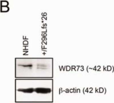 Western Blot: WDR73 Antibody [NBP1-82219]