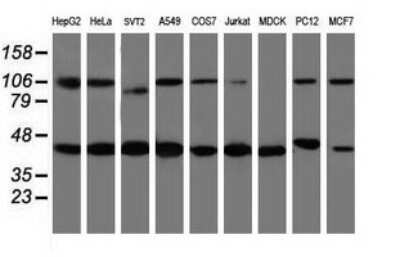 Western Blot: WDR74 Antibody (OTI4B2) [NBP2-45420]