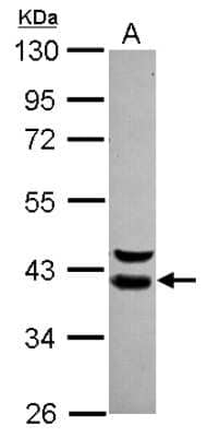 Western Blot: WDR74 Antibody [NBP2-20900]