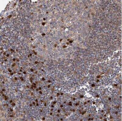 Immunohistochemistry-Paraffin: WDR75 Antibody [NBP1-82296]