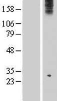 Western Blot: WDR75 Overexpression Lysate [NBP2-06063]