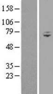 Western Blot: WDR76 Overexpression Lysate [NBL1-17830]