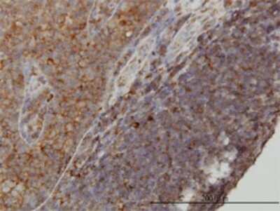 Immunohistochemistry-Paraffin: WDR77 Antibody (3F10) [H00079084-M01]