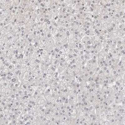 Immunohistochemistry-Paraffin: WDR77 Antibody [NBP1-82778]