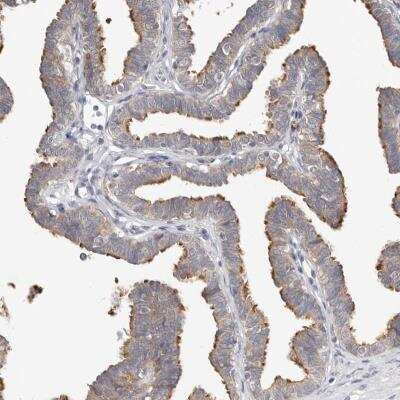 Immunohistochemistry: WDR77 Antibody [NBP1-82779]