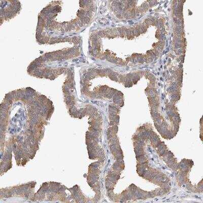 Immunohistochemistry: WDR77 Antibody [NBP1-82780]