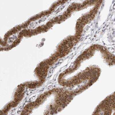 Immunohistochemistry-Paraffin: WDR77 Antibody [NBP1-82778]