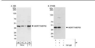 Western Blot: WDR77 Antibody [NB100-77305]