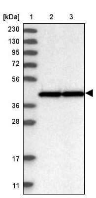 Western Blot: WDR77 Antibody [NBP1-82778]