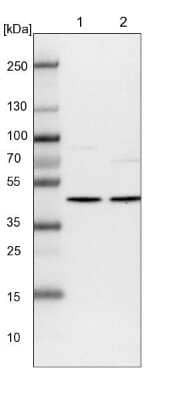 Western Blot: WDR77 Antibody [NBP1-82778]