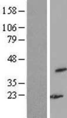 Western Blot: WDR77 Overexpression Lysate [NBL1-17831]