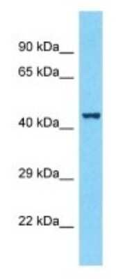 Western Blot: WDR78 Antibody [NBP3-09908]