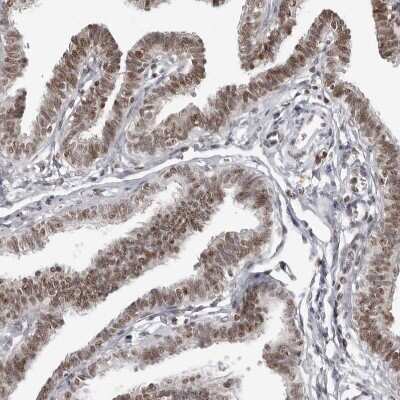 Immunohistochemistry-Paraffin: WDR79 Antibody [NBP1-92593]