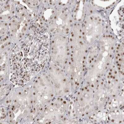 Immunohistochemistry-Paraffin: WDR79 Antibody [NBP1-92593]