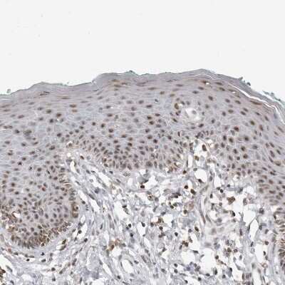 Immunohistochemistry-Paraffin: WDR79 Antibody [NBP1-92593]