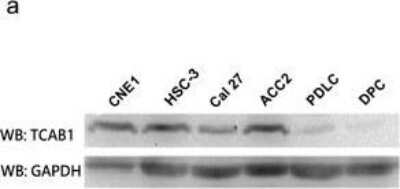 Western Blot: WDR79 Antibody [NB100-68252]