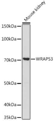 Western Blot: WDR79 AntibodyAzide and BSA Free [NBP3-15968]