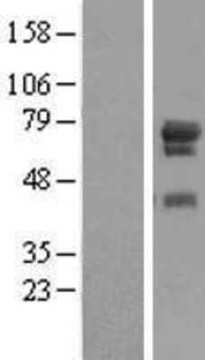 Western Blot: WDR79 Overexpression Lysate [NBP2-11361]