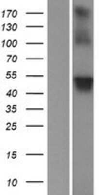 Western Blot: WDR8 Overexpression Lysate [NBP2-06915]