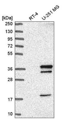 Western Blot: WDR82 Antibody [NBP2-57428]