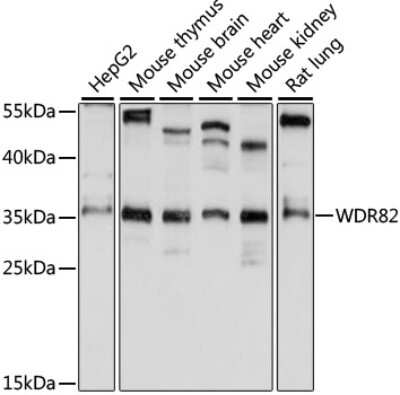 Western Blot: WDR82 AntibodyAzide and BSA Free [NBP2-93148]