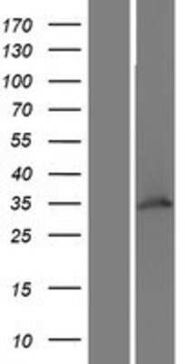 Western Blot: WDR82 Overexpression Lysate [NBP2-06206]