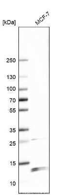 Western Blot: WDR83OS Antibody [NBP2-55905]