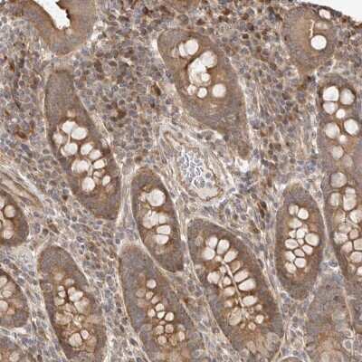 Immunohistochemistry-Paraffin: WDR85 Antibody [NBP1-86714]
